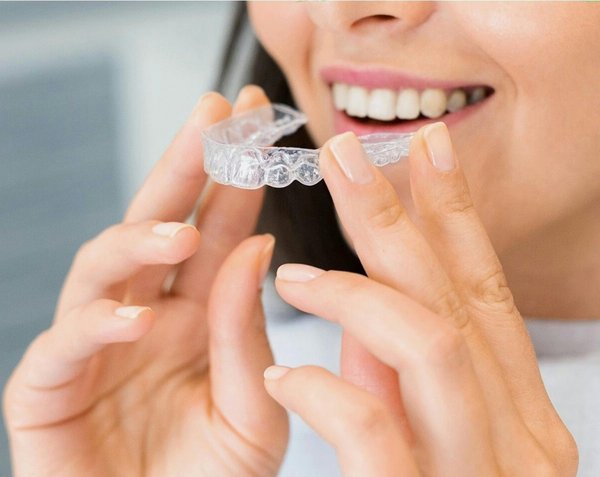 Invisalign lille : réalisez un sourire discret et éclatant